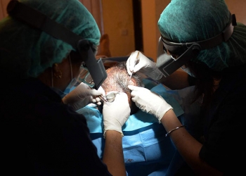 Nouvelle méthode de culture ultra-rapide des cheveux