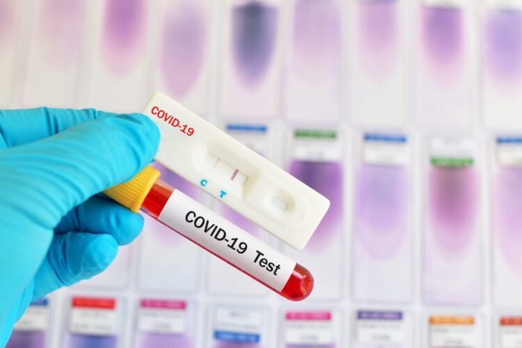 France : Plus de 8.500 nouveaux cas de contamination au Covid-19 en 24h