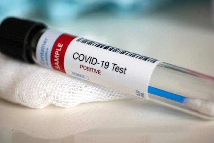 Tunisie : 1.297 nouveaux cas de contaminations en 24 heures