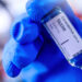 La Tunisie parmi les derniers pays au monde qui n'ont pas commencé à vacciner