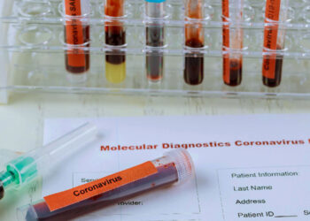 Tunisie : Plus de 1.200 nouveaux cas de contaminations au Covid-19 en 24 heures