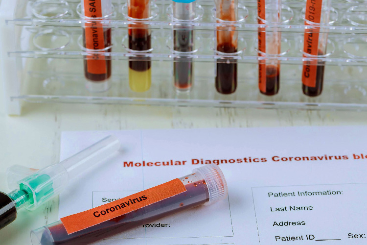 Tunisie : Plus de 1.200 nouveaux cas de contaminations au Covid-19 en 24 heures