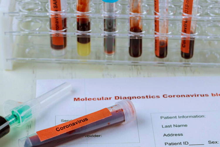 Tunisie: plus de 1.302 nouveaux cas de contamination en 24 heures